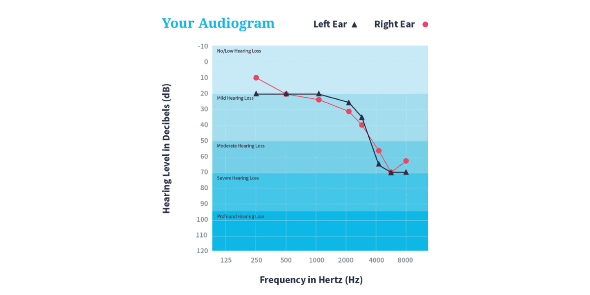 audiogram