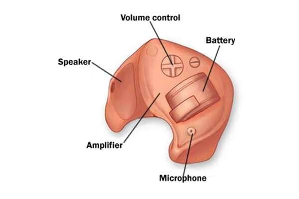 how does a hearing aid work