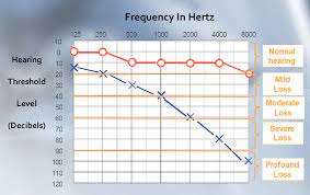 online hearing testing