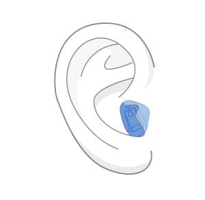 In the ear hearing aid illustration