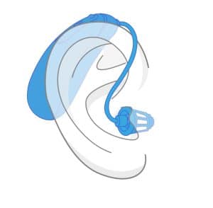 Receiver in Canal Illustration of Hearing Aid